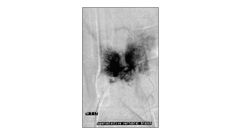 peristatiko aimaggeiwmatos spondulikhs sthlhs.004
