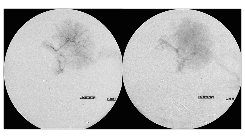peristatiko 1 ogkou xorioeidous plegmatos.004