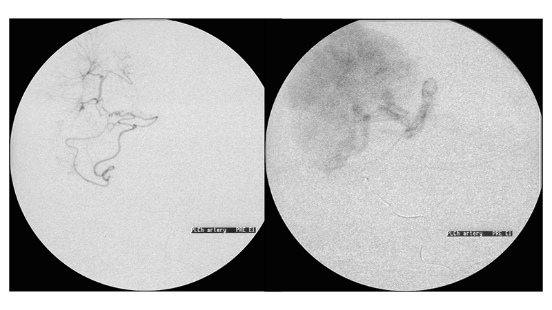 peristatiko 1 ogkou xorioeidous plegmatos.005