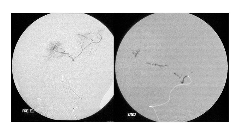 peristatiko 2 ogkou xorioeidous plegmatos.005