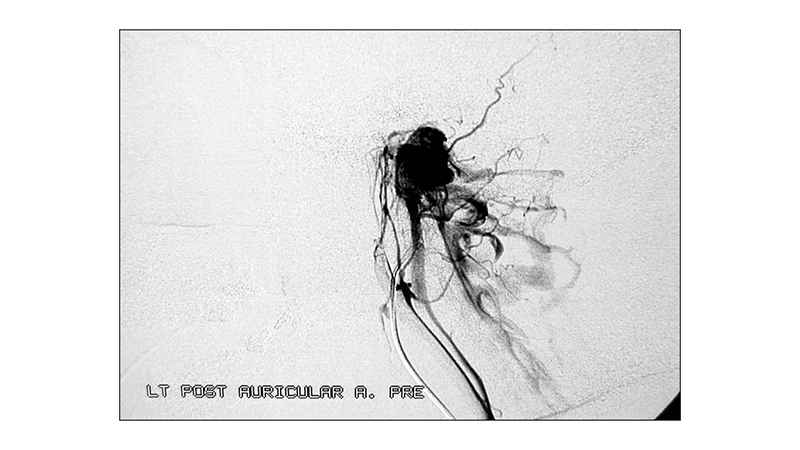 peristatiko 5 paragaggliwmatos ozwdous gaggliou.004