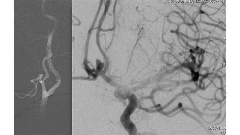 peristatiko 11 Page 1